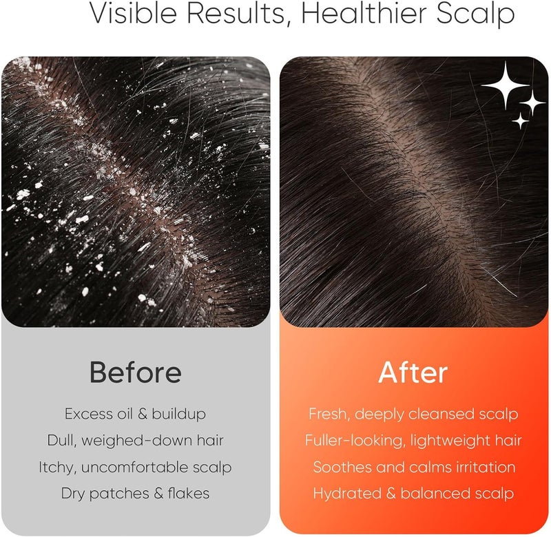 EKZ Sonic Vibrating Scalp Massager Shampoo Brush: Electric Silicone Hair Scrubber for Deep Scalp Clean, Dandruff Removal, Exfoliation, Stress Relief & Hair Growth –Suitable for Women, Men, Kids & Pets - Image 4